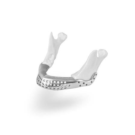 Obrázek reference